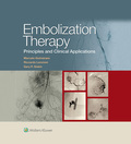 Embolization Therapy: Principles and Clinical Applications