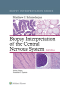 Biopsy Interpretation of the Central Nervous System