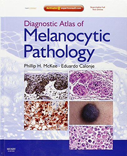 Diagnostic Atlas of Melanocytic Pathology: Expert Consult: Online and Print, 1e (Expert Consult Title: Online + Print)