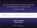 Rapid Interpretation of ECGs in Emergency Medicine: A Visual Guide