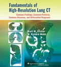 Fundamentals of High-Resolution Lung CT: Common Findings, Common Patterns, Common Diseases, and Differential Diagnosis