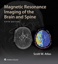 Magnetic Resonance Imaging of the Brain and Spine