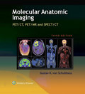 Molecular Anatomic Imaging