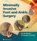 Minimally Invasive Foot & Ankle Surgery