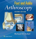Foot & Ankle Arthroscopy