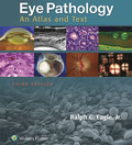 Eye Pathology