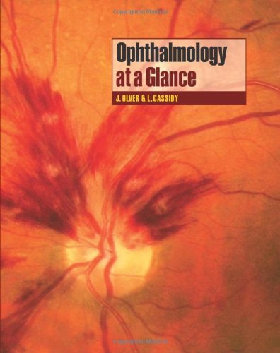 Ophthalmology at a Glance