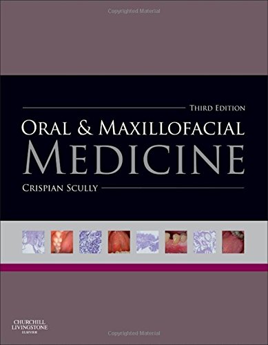 Oral and Maxillofacial Medicine: The Basis of Diagnosis and Treatment, 3e