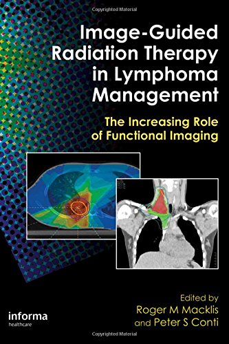 Image-Guided Radiation Therapy in Lymphoma Management: The Increasing Role of Functional Imaging